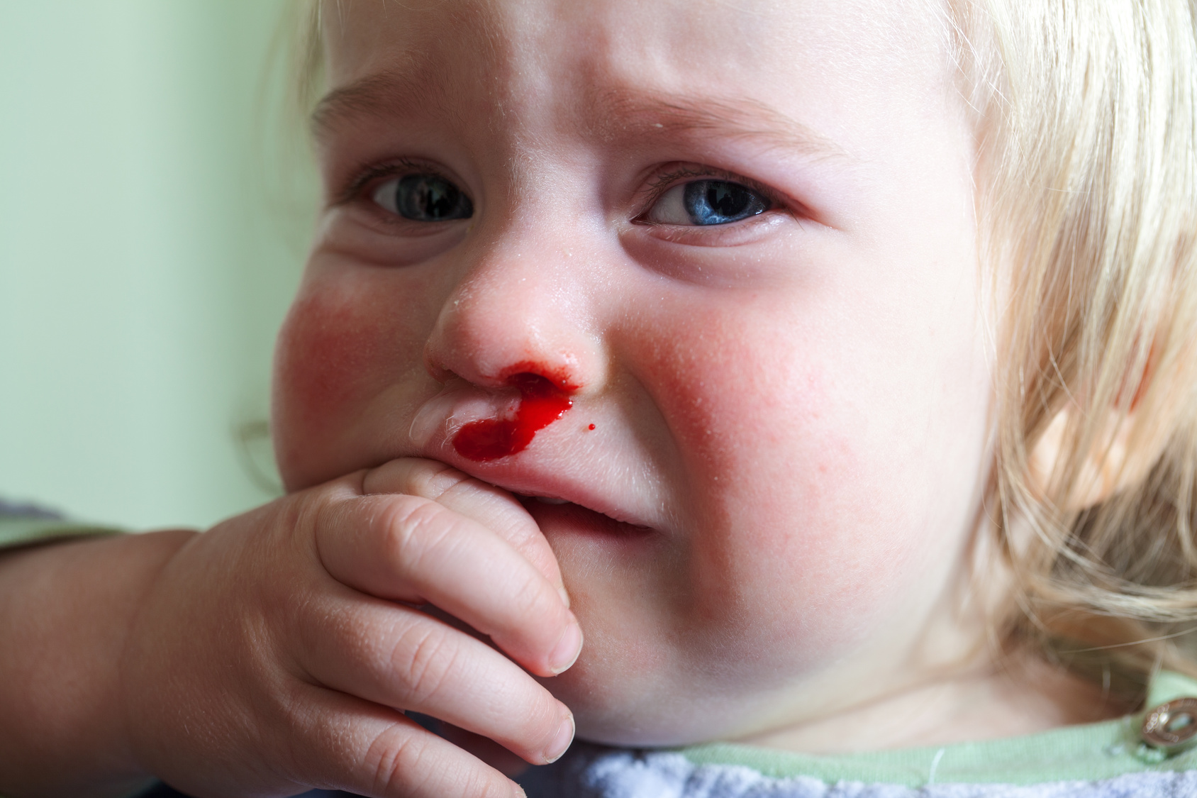 krew z nosa u dziecka